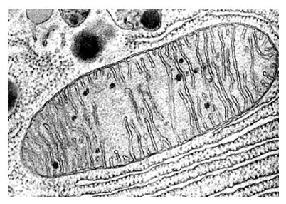 mitocrondio-al-microscopio
